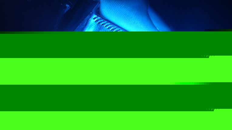 Using medical technology to keep our engines healthy